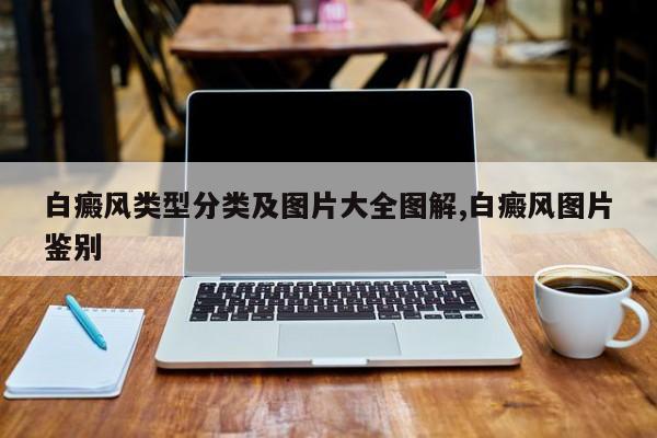 白癜风类型分类及图片大全图解,白癜风图片鉴别