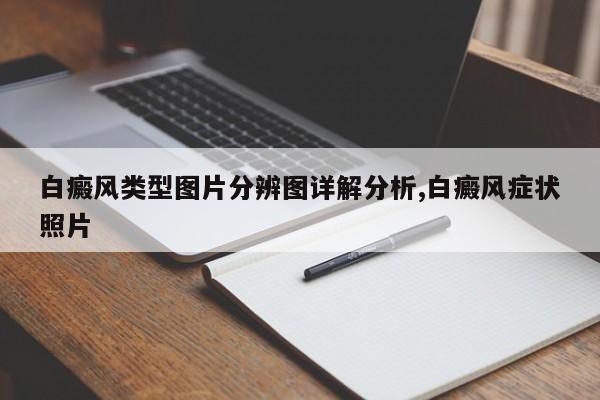 白癜风类型图片分辨图详解分析,白癜风症状照片
