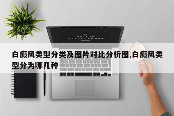 白癜风类型分类及图片对比分析图,白癜风类型分为哪几种