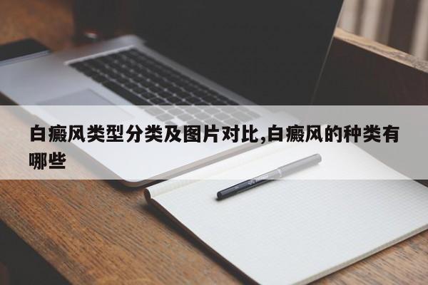 白癜风类型分类及图片对比,白癜风的种类有哪些
