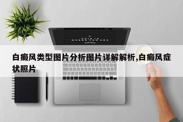 白癜风类型图片分析图片详解解析,白癜风症状照片