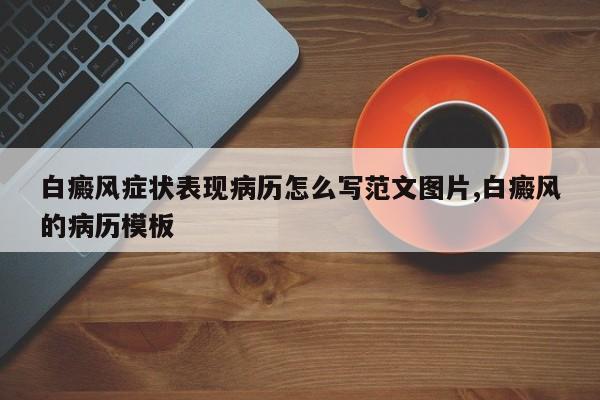 白癜风症状表现病历怎么写范文图片,白癜风的病历模板