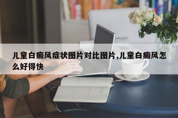 儿童白癜风症状图片对比图片,儿童白癜风怎么好得快