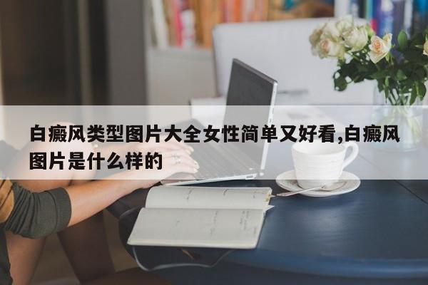 白癜风类型图片大全女性简单又好看,白癜风图片是什么样的