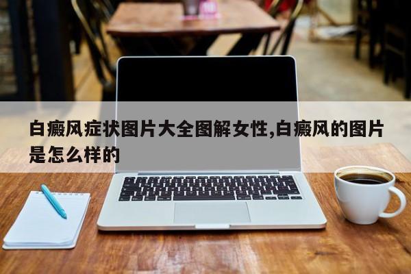 白癜风症状图片大全图解女性,白癜风的图片是怎么样的