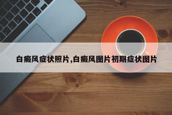 白癜风症状照片,白癜风图片初期症状图片
