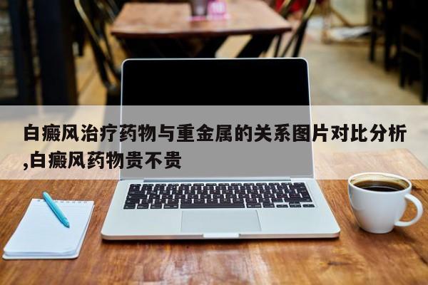 白癜风治疗药物与重金属的关系图片对比分析,白癜风药物贵不贵